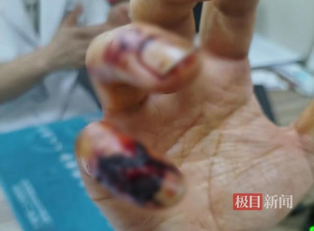 店主阻拦城管撕门口广告起冲突，手指遭对方咬破，路人劝他“别冲动，想想你儿子”，兰州城管局回应