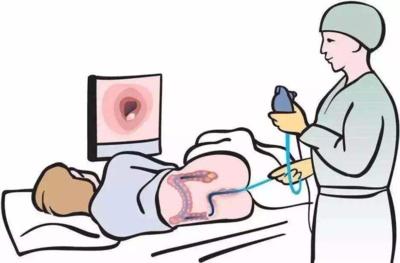 睡一觉就做完了胃肠镜检查！