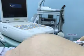 11斤！阜阳11岁女孩，肚中取出……图片