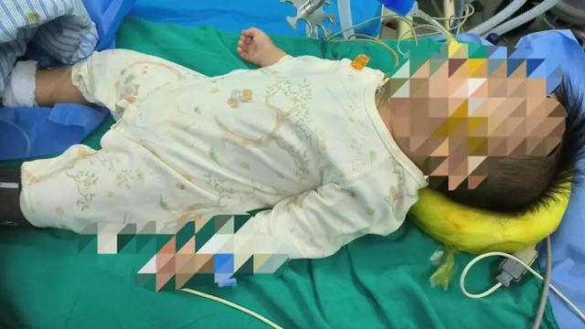 广州一11个月婴儿误吞妈妈枕边的祈福币险窒息，医生：每年接诊多起，家长需留意