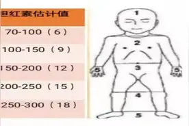 新生儿“小黄人”的那些事，带你一键解锁图片