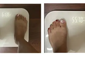 女子瘦了20斤后，闺蜜团想一起“穴位埋线”！这种中医疗法究竟怎么样？图片