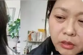 42岁女子自称20天“老了三十多岁”，网友直呼不敢相信！什么是“断崖式衰老”？图片