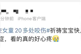 女童遭恶犬撕咬最新通报！被狗咬伤后怎么办？应该这样处置→图片