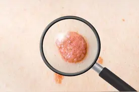 脖子和腋下长的小肉粒是什么？好想抠——揭秘“皮肤上的秘密”图片