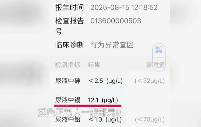 女子称服用祖传秘方药丸后，出现幻觉和锡中毒症状！卫生部门：停诊，向群众征集线索！