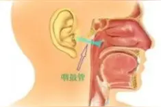 永医科普丨耳部不适 需警惕鼻咽癌图片