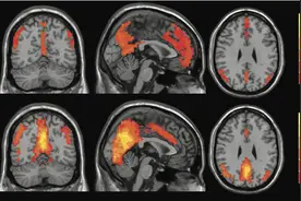 吃脑补脑？人脑只被开发了10%？这5个关于大脑的谣言，快别信了！图片