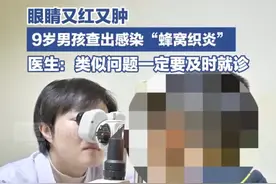 眼睛又红又肿，9岁男童查出感染“蜂窝织炎”图片