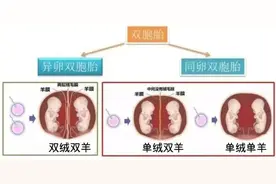 三胞胎同挤一“房间”，医院240天护航助孩子平安出生图片