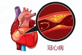 冠心病防治知识全解析，早知道早预防图片