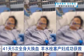 救回来了！41天5次全身大换血，羊水栓塞产妇成功获救图片