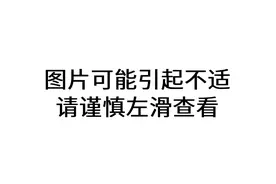 剪指甲的一个小习惯，可能导致甲沟炎反复发作！快看看中招没图片