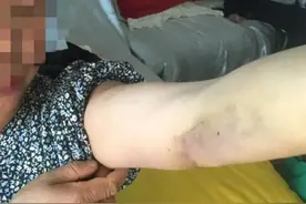 59岁女子去赌场讨债被民警当成赌徒并打断三根肋骨？武汉警方回应图片