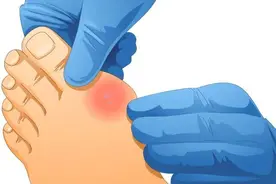 七日食谱，助你度过痛风急性发作期！图片