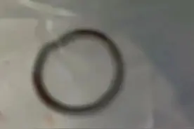 54岁的妈妈，“28岁”的节育环图片