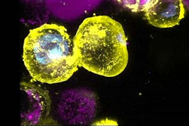 研究发现至少数百万人携带