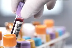 日本冈山县部分居民血检异常，疑因自来水污染图片