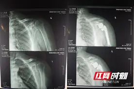 这种“钓鱼病”总是缠绕钓鱼人 看看你中招了吗图片