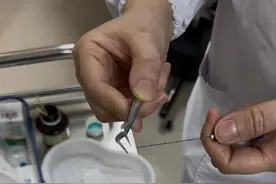 一根针能减肥？中医“神器”真能“躺瘦”图片