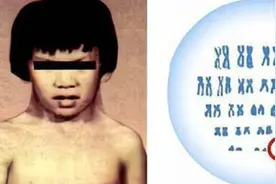全世界不过30例！他的Y染色体不见了，还能生育吗？图片