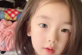 7岁女孩天生异瞳，眼睛一蓝一棕！妈妈：不影响视力图片