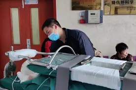 19岁烧伤女孩进行首次面部植皮，医生：前几次植皮基本达到预期效果图片
