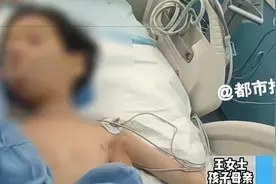 狂犬病发病后致死率近100%！这些救命知识要知道→图片
