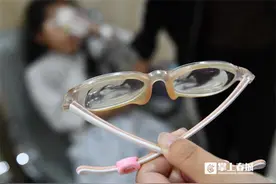 8岁女童近视“狂飙”达1500度 后巩膜加固手术挽救病理性近视图片
