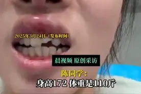 女生液断减肥3天晕倒磕掉半边门牙：突然失去意识晕倒图片