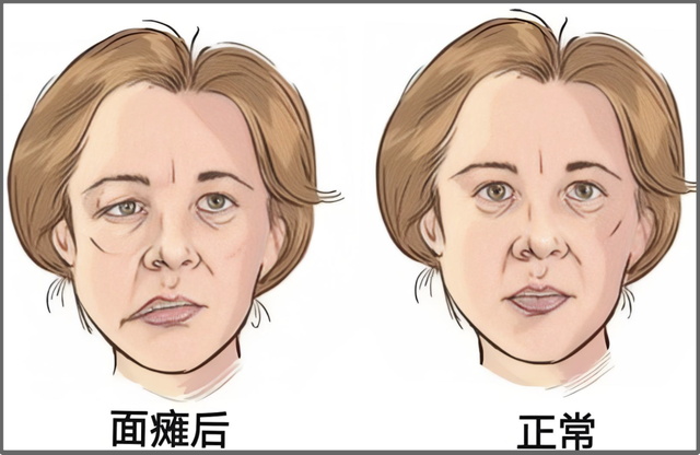 为什么泉州遍地都是面瘫广告？