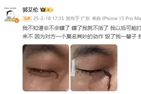 新闻多一度丨郭艾伦眼睛受伤引关注 运动时我们该如何保护双眼？图片