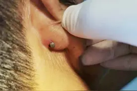 警惕！进入高发季，已有人中招！处理不当很危险图片