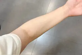 拧毛巾时总是手肘痛，是怎么回事？可能是这里出了问题！图片