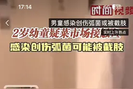 被海鲜扎一下就可能导致死亡 警惕创伤弧菌感染！图片