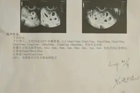 太罕见！25岁女子怀上9胞胎，专家这样说图片