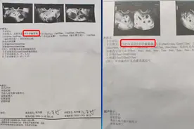 江西25岁宝妈怀9胞胎又惊又喜，网友调侃8个瑞士卷都不够分，医生称产妇风险极大应考虑减胎图片