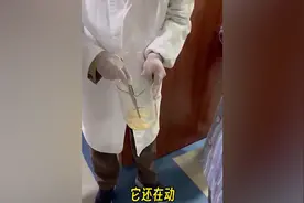 女子肛门处刺痒难忍 医院用“南瓜籽+槟榔”驱虫排出长达10米寄生虫图片