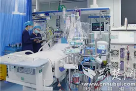 ECMO上演生死“室”速 女子心脏停跳18小时后奇迹“重生”图片