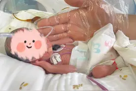 体重仅1斤多！巴掌大小！合肥一医院紧急救治早产双胞胎图片