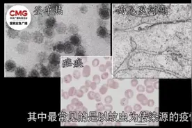 小心水里这个“隐形刺客”！如何避免被钩体病“钩上”？图片