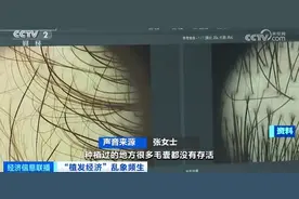 曝光了！“没长出来”“秃的”！有人欠下万元“植发贷”……图片