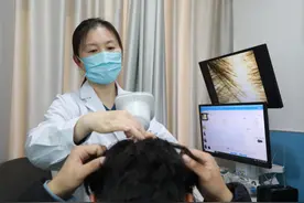 年轻人惨遇“秃头危机”？滨医附院皮肤科高昱细说脱发！图片