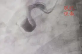 23岁小伙常年熬夜打游戏，突发心梗差点送命图片