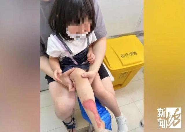 把手断裂 火锅店整壶高汤浇母女身上