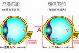 儿童青少年近视防控，“防”的到底是什么?图片