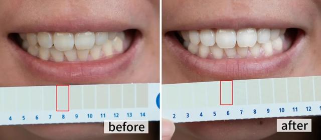 咖啡是白天喝的	，牙是夜里变黄的