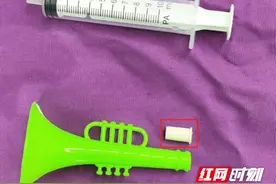 玩具零件误入儿童气管！专家巧手精准取出图片