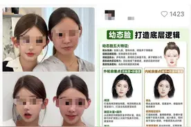 潮颜课题 | “幼态脸”审美风，刮到你了吗？图片