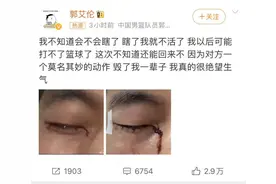 缝了40多针！郭艾伦发文“毁了我一辈子”，俱乐部最新回应图片
